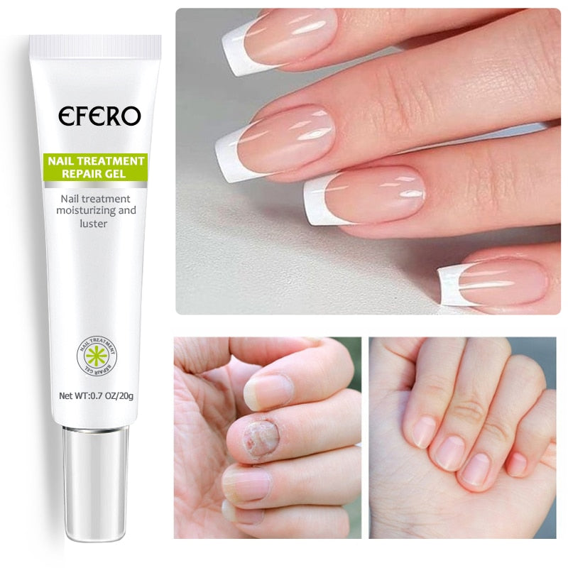 EFERO - Creme Anti - Inflamatório Para Remoção de Fungos + BRINDE